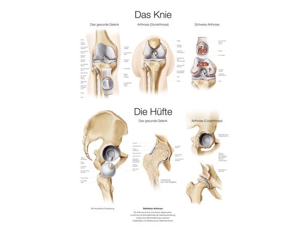 Plakat The Knee & Hip 50 x 70 cm Plast